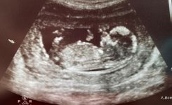 Diario de una fisio embarazada: Primer trimestre