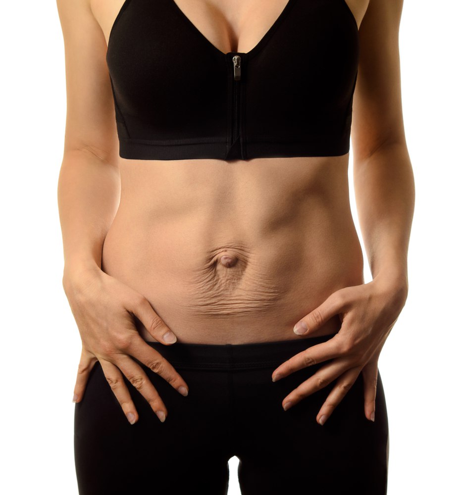 00_diastasis_abdominal