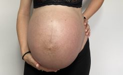 Diario de una fisio embarazada: Síntomas curiosos en el embarazo